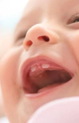 baby teeth