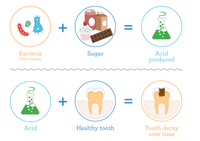 The tooth decay process